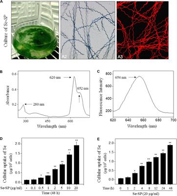 Selenium-Containing Protein From Selenium-Enriched Spirulina platensis Attenuates High Glucose-Induced Calcification of MOVAS Cells by Inhibiting ROS-Mediated DNA Damage and Regulating MAPK and PI3K/AKT Pathways